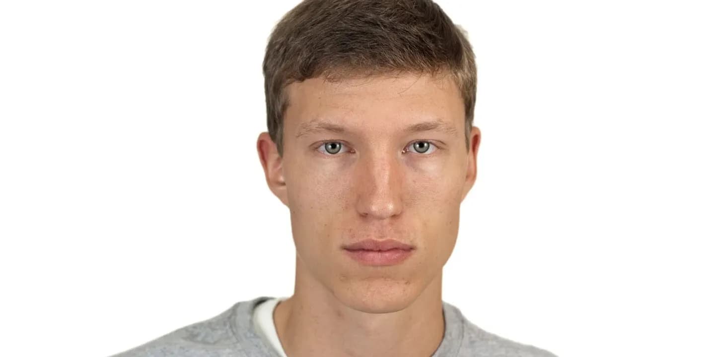 Кольца лимбуса: здорово, но не привлекательно