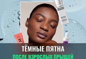 Взрослые прыщи и тёмные пятна: как с ними жить