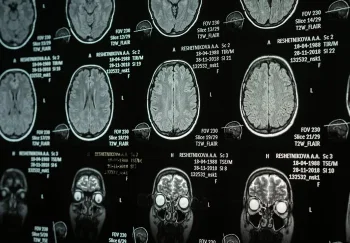 Травма перепрошивает мозг: кому легче — тот кому больно?