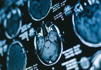 Мозг при СДВГ: почему застреваем в настоящем