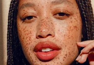 8 лучших минеральных кремов от солнца: не страшно даже чувствительной коже