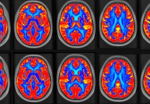 Как арахис поборол старческую забывчивость — и зачем нам это знать
