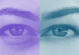 Инъекции под глаза: тайны и опасности модной процедуры