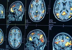 Депрессия и подростки