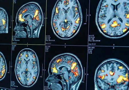 Депрессия и подростки