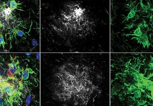 Фермент‑тормоз и память