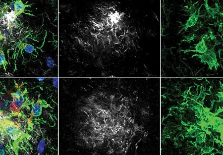 Фермент‑тормоз и память