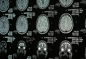 El multilingüismo y el cerebro que envejece