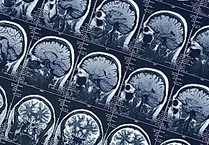 Cambiar de trabajo, perder cerebro: científicos alertan del deterioro cerebral de los «noctámbulos»