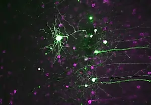 El cerebro activa el modo «a trabajar»