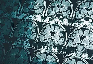 Una infancia sin cuidados cambia el cerebro