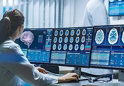 El cerebro puede revelar el riesgo de depresión años antes de que aparezcan los síntomas
