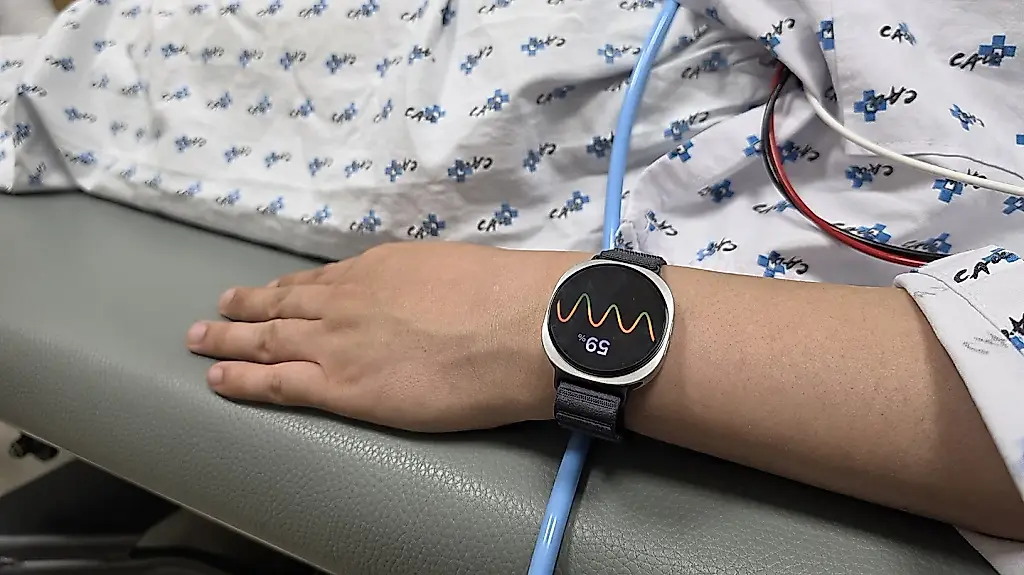 Samsung: Galaxy Watch aprende a predecir desmayos con «gran precisión»