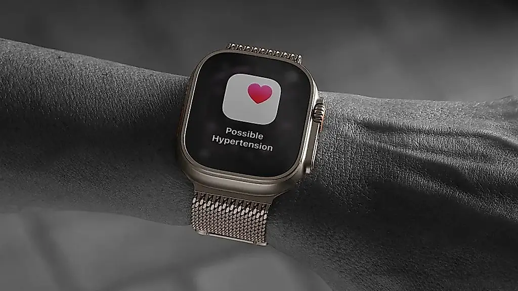 Chollos para el Apple Watch