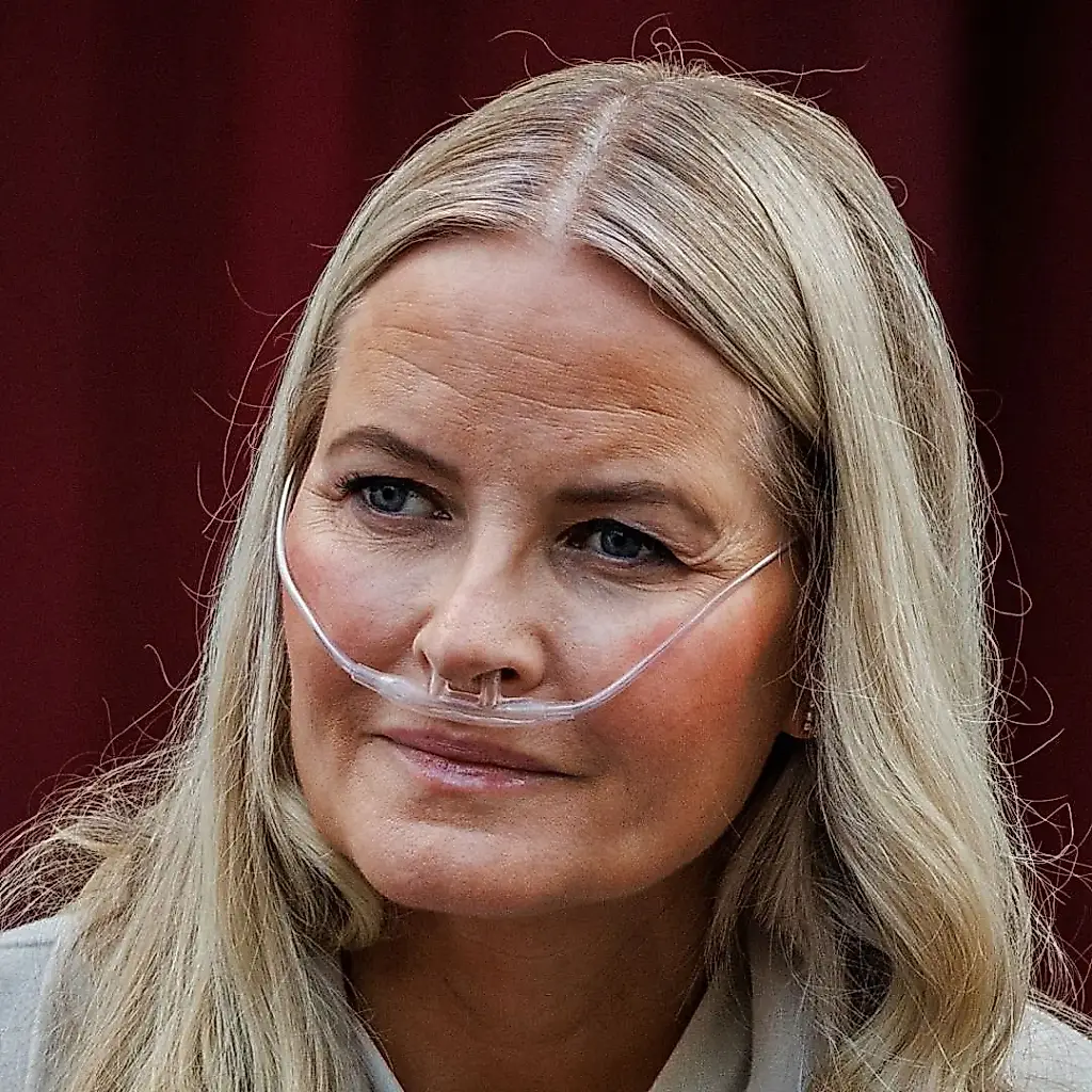La reina de Noruega, hospitalizada tras un trasplante de pulmón