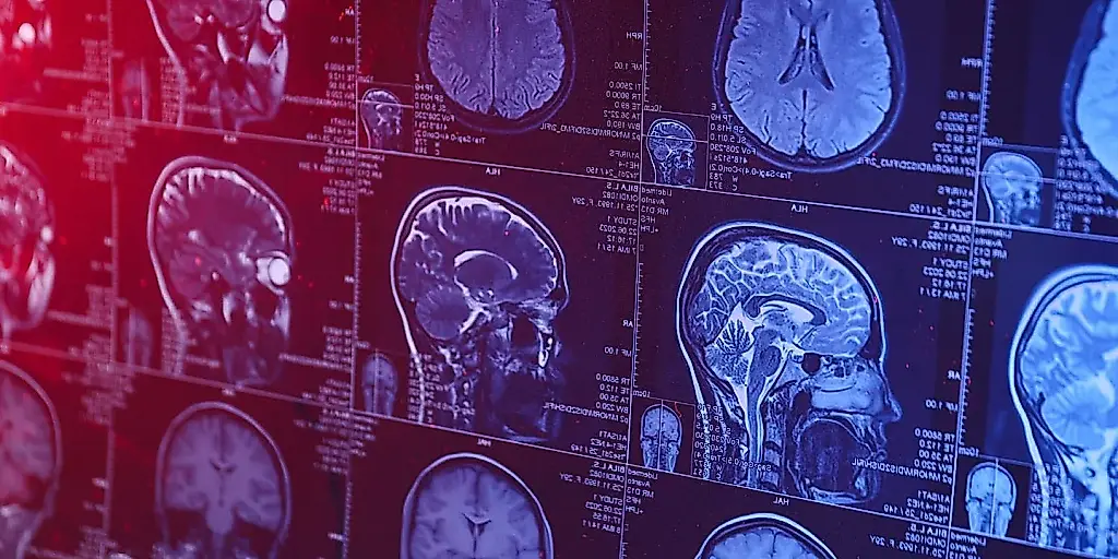 Antidepresivos y cerebro: una gran comprobación sin alarmismos