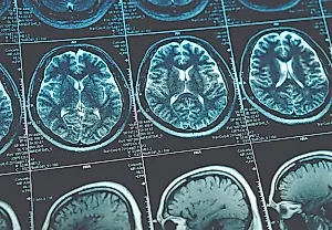 Неизображаемое воображение: как нейробиология обнажает тайны aphantasia