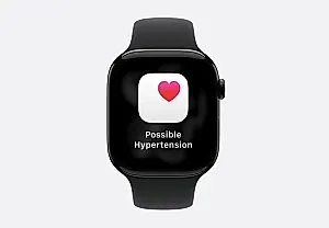 Apple Watch теперь сможет обнаруживать гипертонию: как это работает и зачем нужно