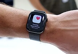 Apple Watch Series 11 получил разрешение FDA на функцию предупреждения о гипертонии