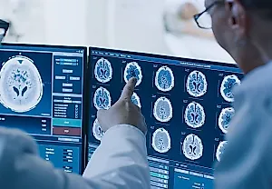 Импульсивность подростков и суицидальные мысли: мозг против кошелька