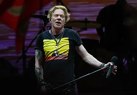 Axl Rose рассказал о борьбе с ТМЖ: «Челюсть будто вот-вот отвалится»