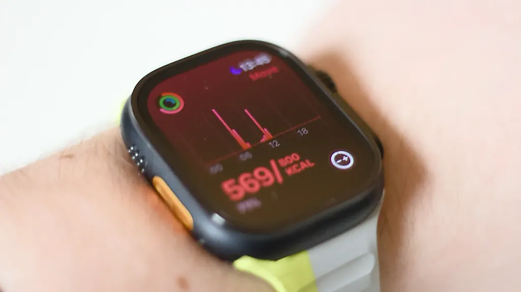 Топ ошибок владельцев Apple Watch: как не стать жертвой своих железок