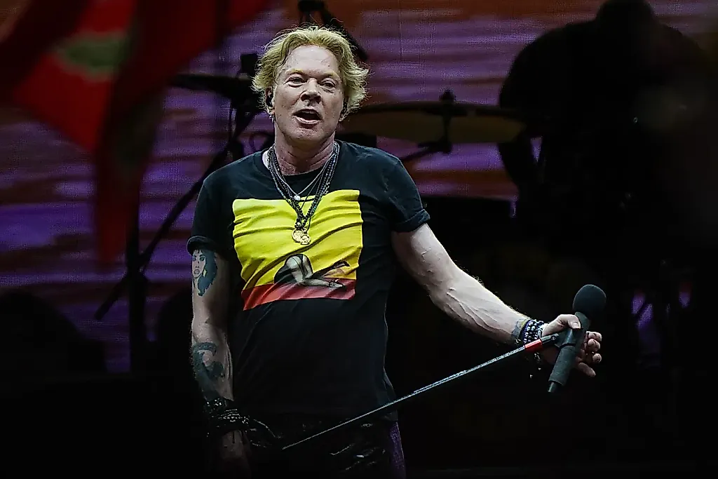 Axl Rose рассказал о борьбе с ТМЖ: «Челюсть будто вот-вот отвалится»