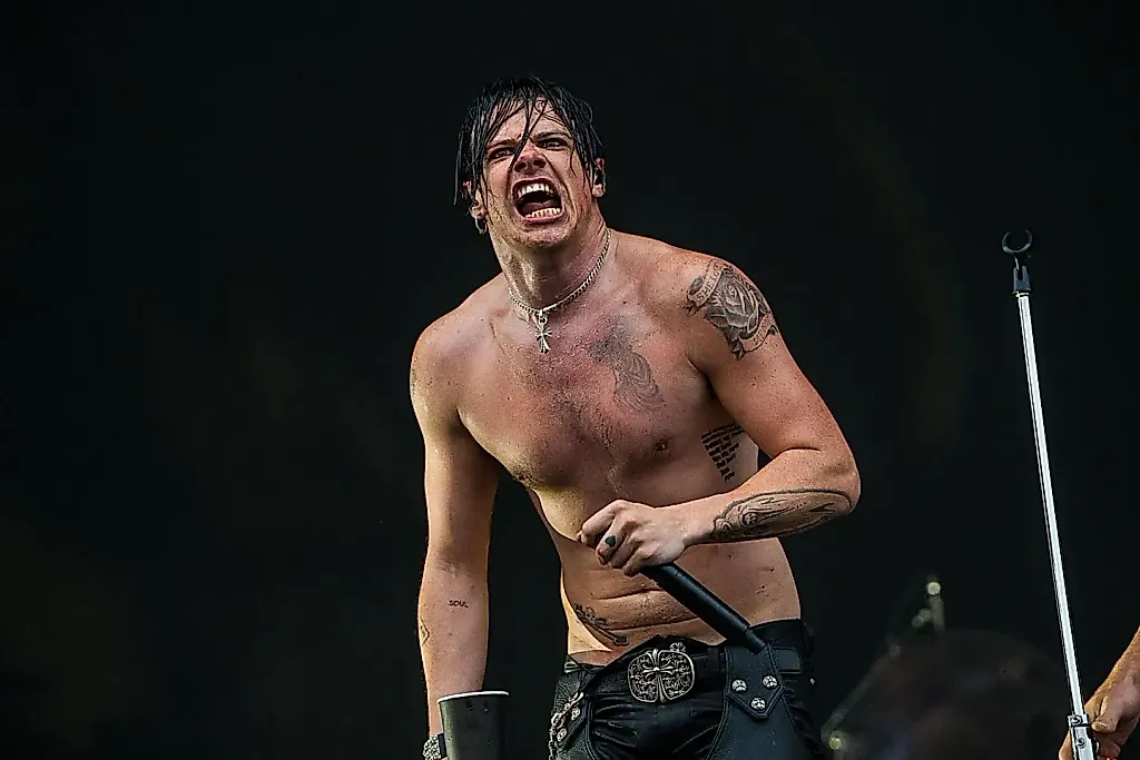 Yungblud ломает ногу, но не отменяет концерты