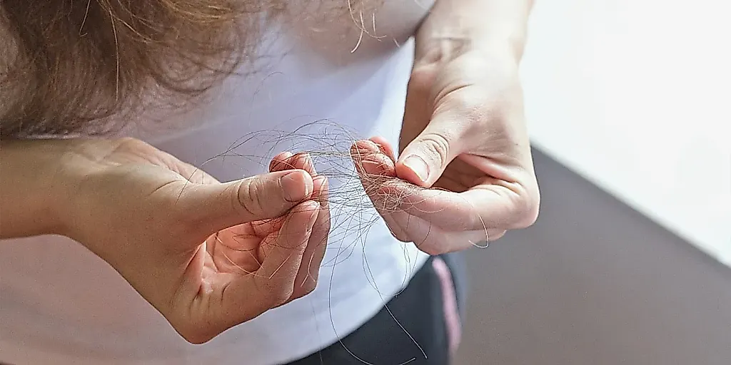 Трихотилломания: скука и усталость важнее стресса