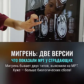 Два типа мозга при мигрени: открытие учёных