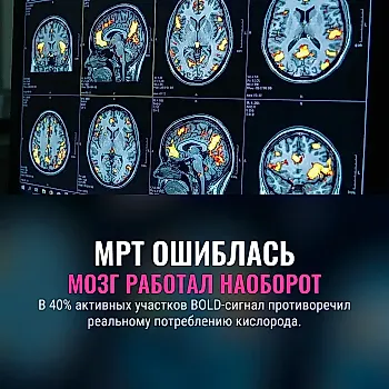 МРТ могло читать мозг наоборот
