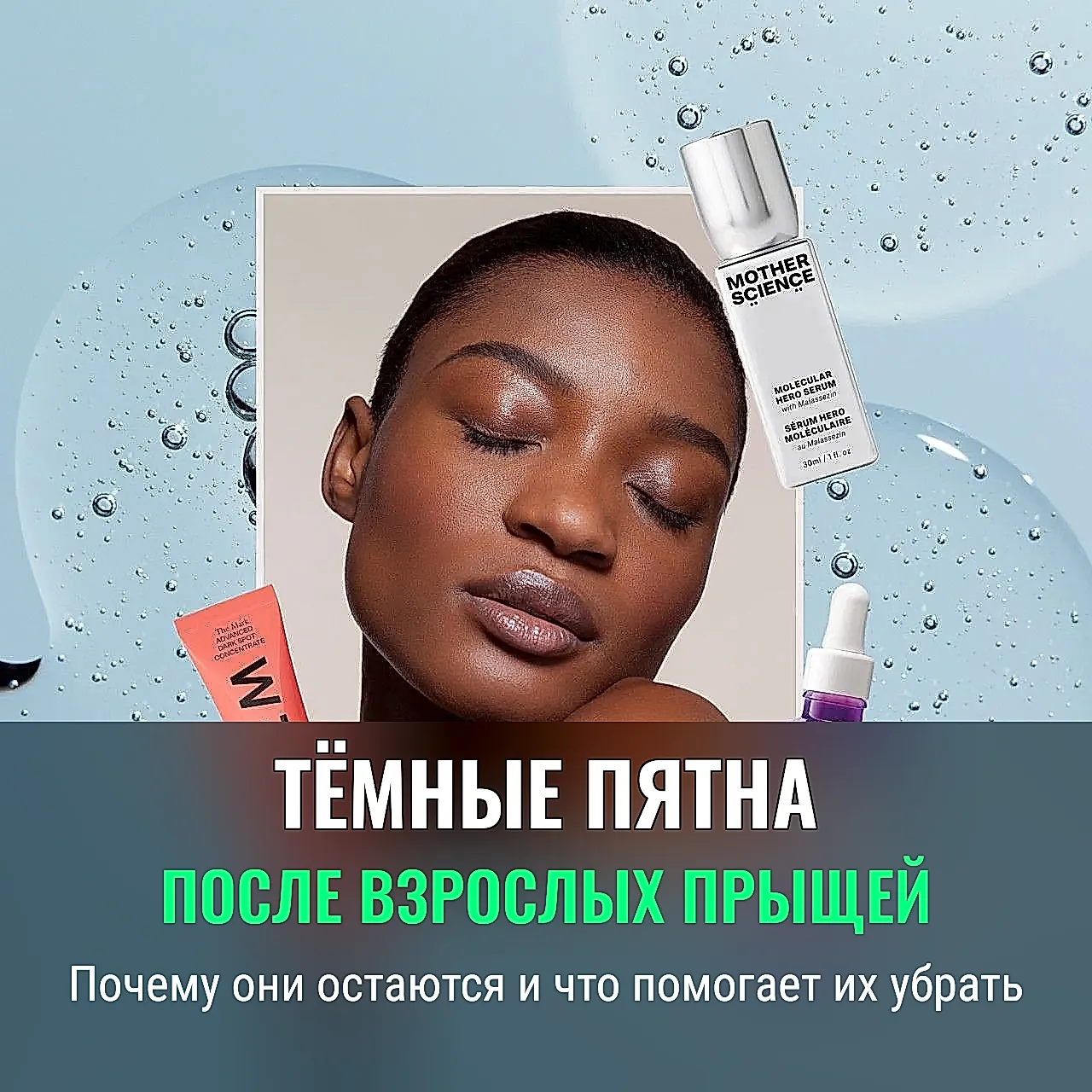 Взрослые прыщи и тёмные пятна: как с ними жить