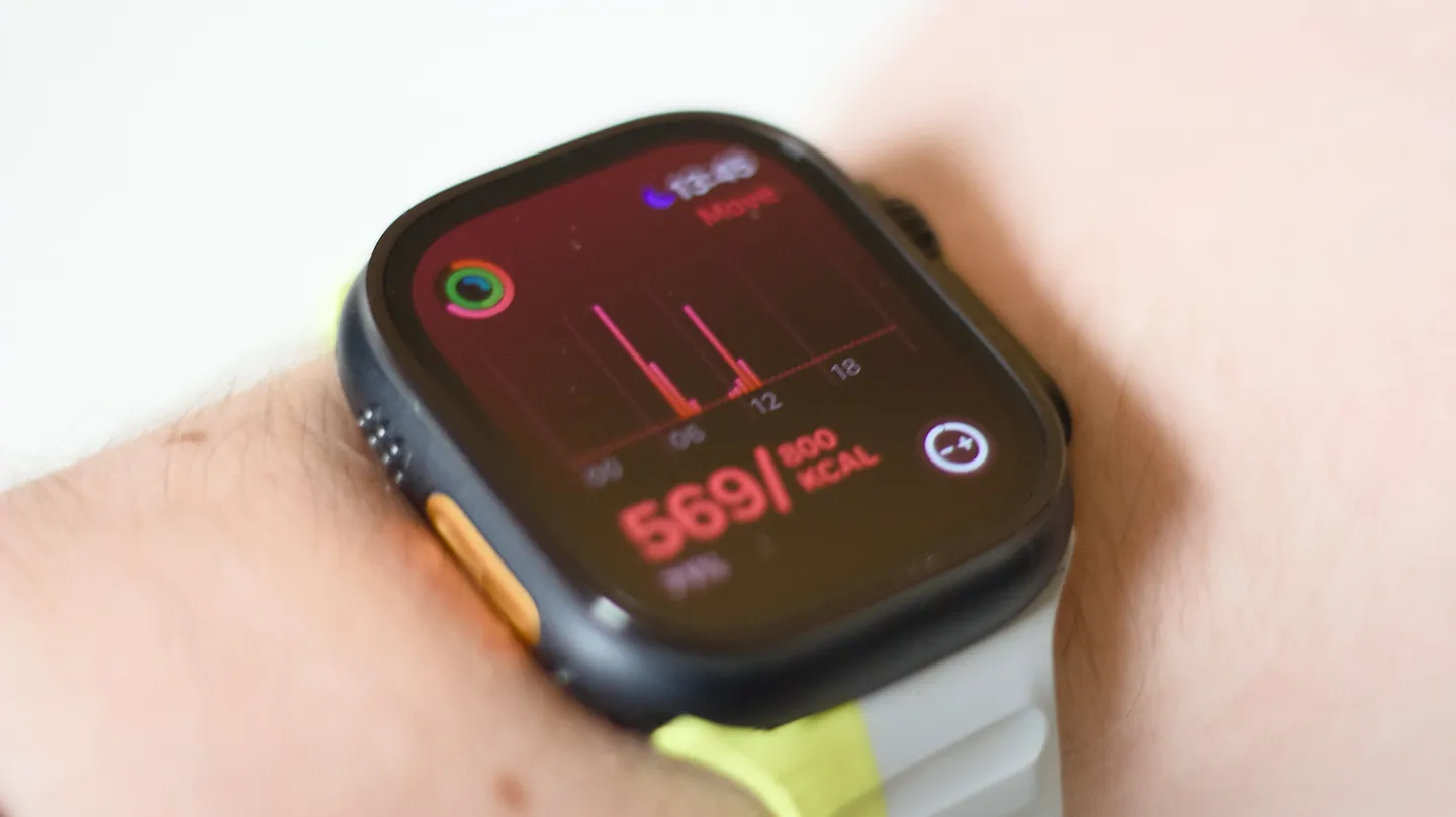 Топ ошибок владельцев Apple Watch: как не стать жертвой своих железок