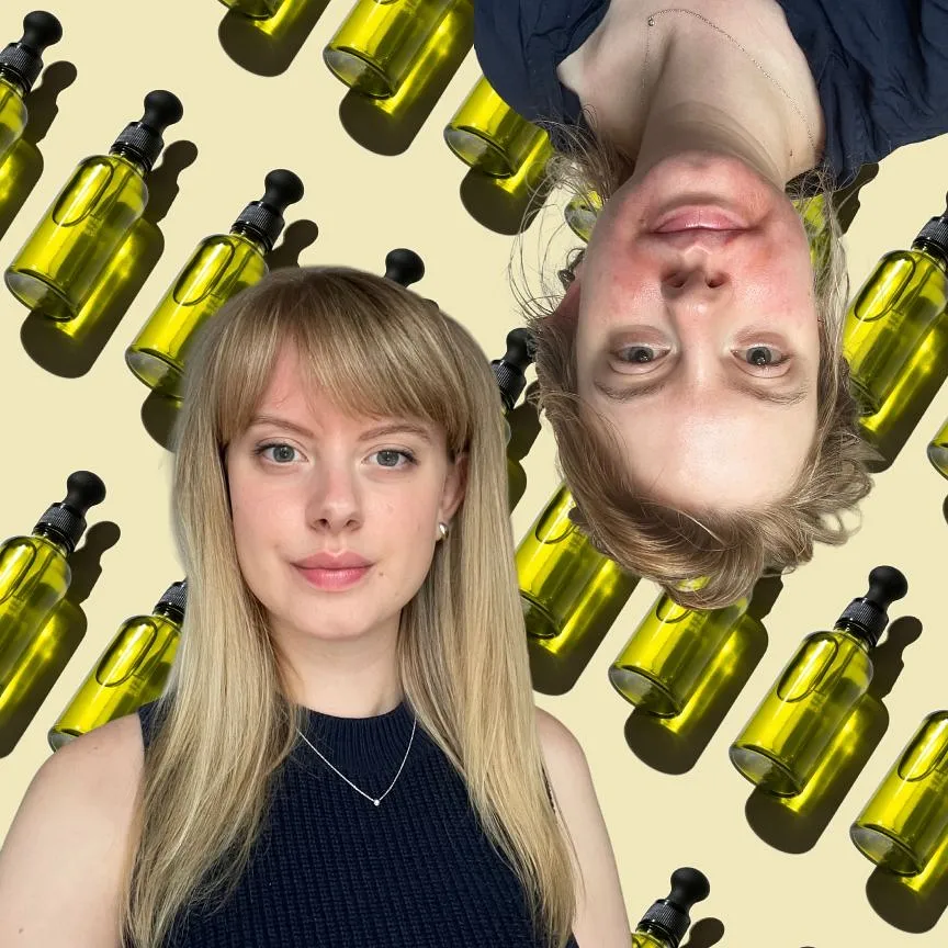 Как погоня за идеальной кожей едва не сожгла лицо: личный опыт beauty-журналиста