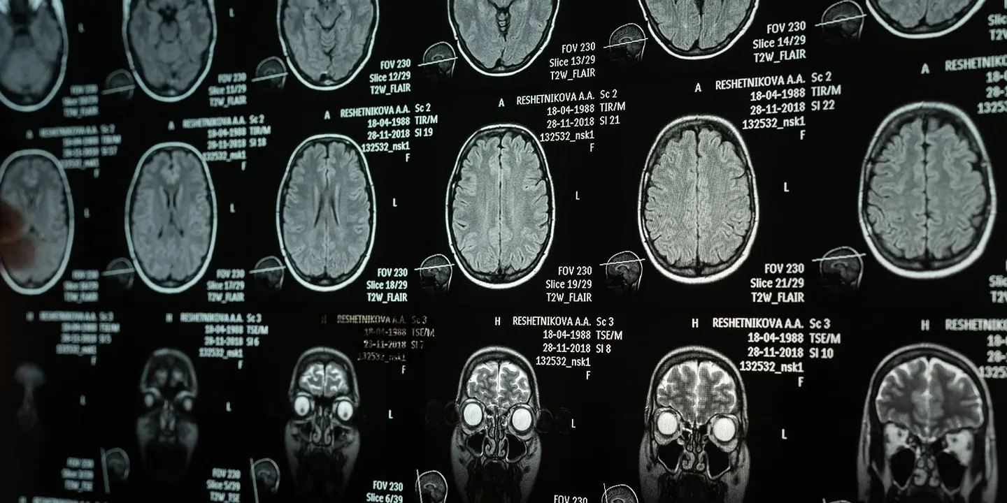 Травма перепрошивает мозг: кому легче — тот кому больно?