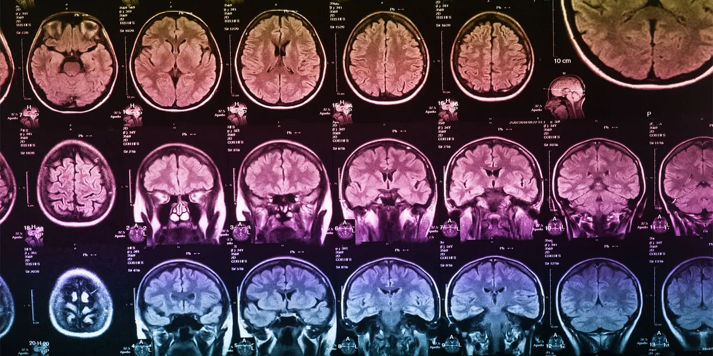 Музыка и система опиоидов мозга