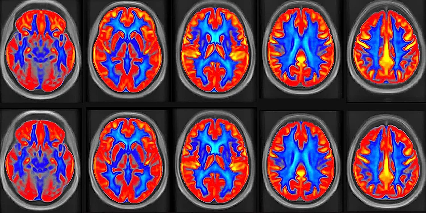 Как арахис поборол старческую забывчивость — и зачем нам это знать