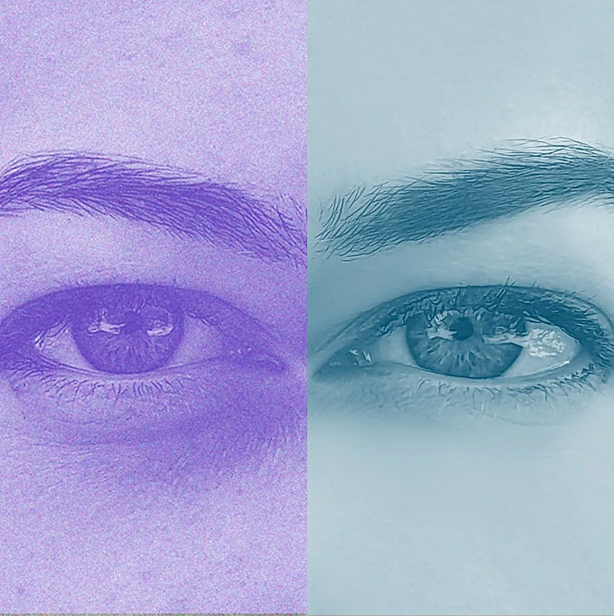 Инъекции под глаза: тайны и опасности модной процедуры