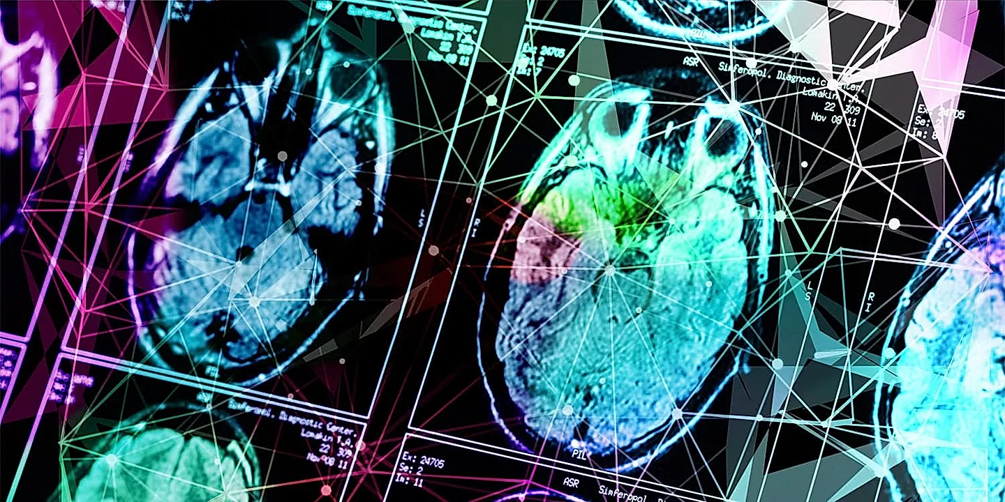 Биологический секрет: почему женщины страдают от Альцгеймера сильнее?