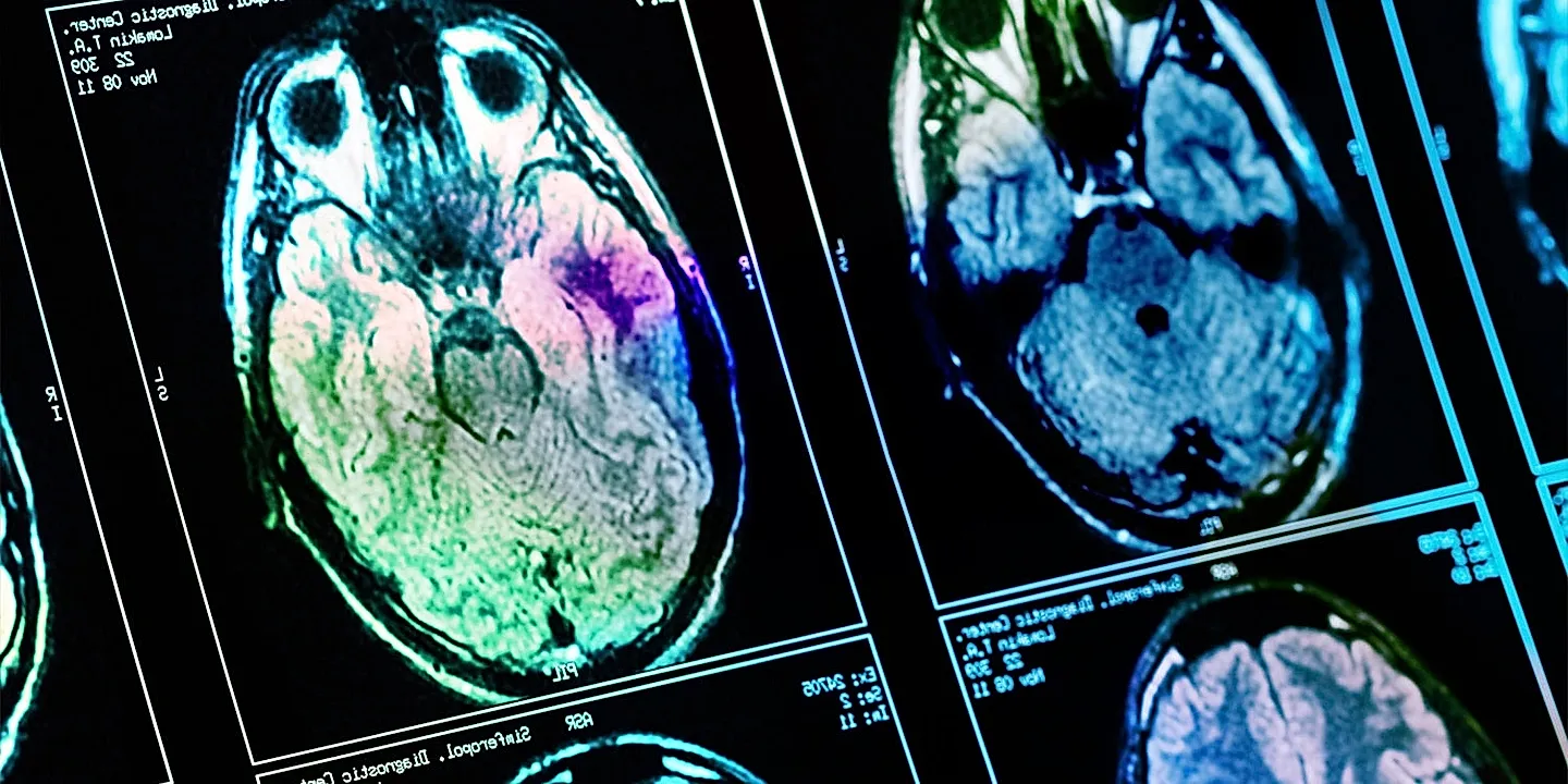 Богатство в мозгах