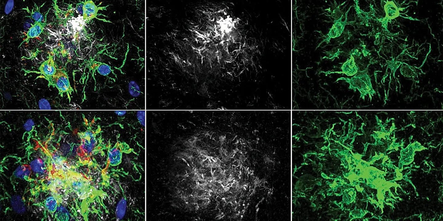 Фермент‑тормоз и память