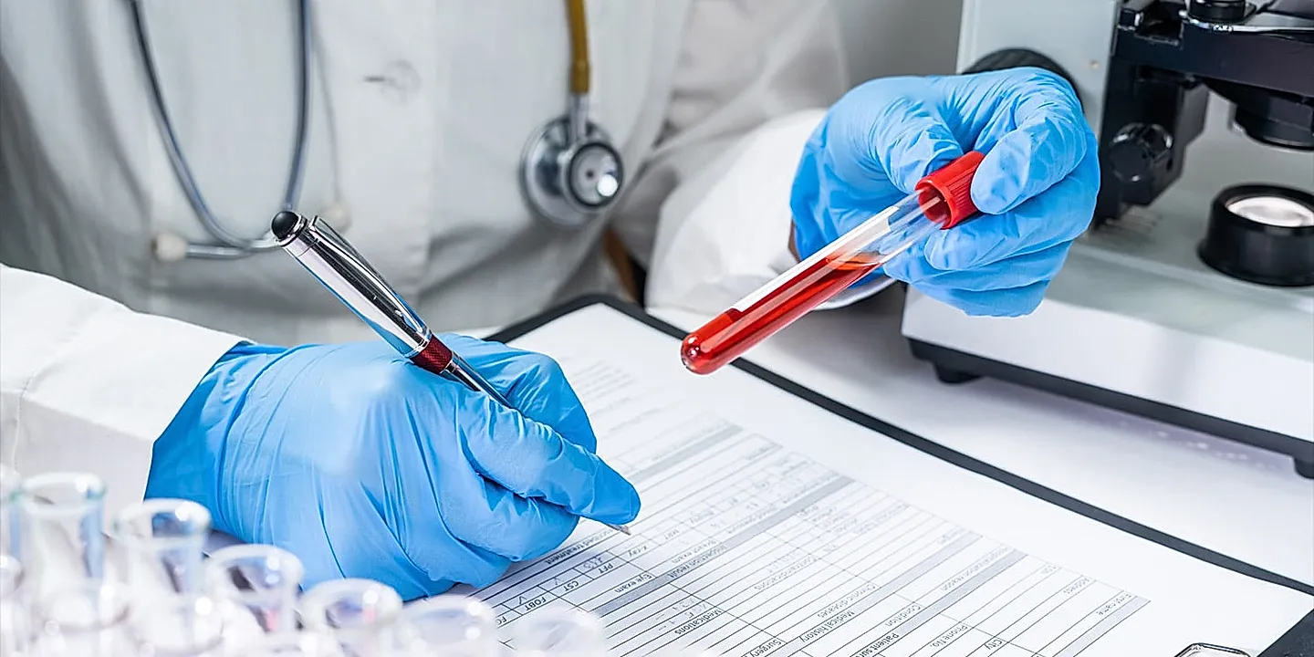 Кривые белки против Альцгеймера