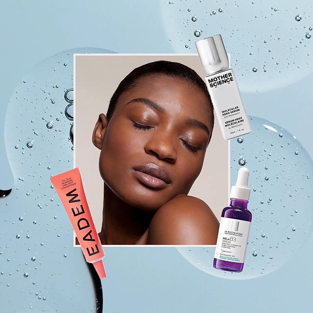 Взрослые прыщи и тёмные пятна: как с ними жить