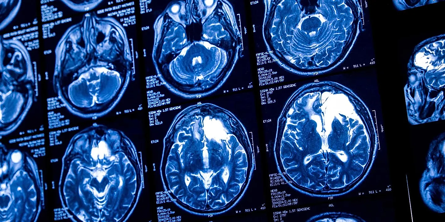 Когда «легкое» питье тоньше коры